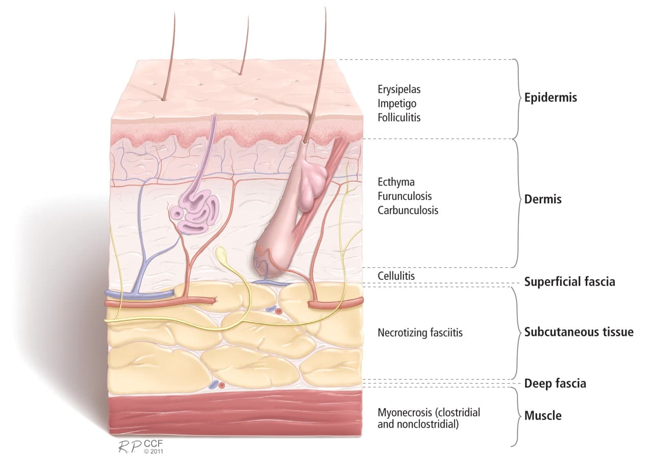 Skin and soft tissue anatomy